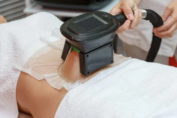 Image of person having fat freezing treatment to help weight gain Stevenage Ware