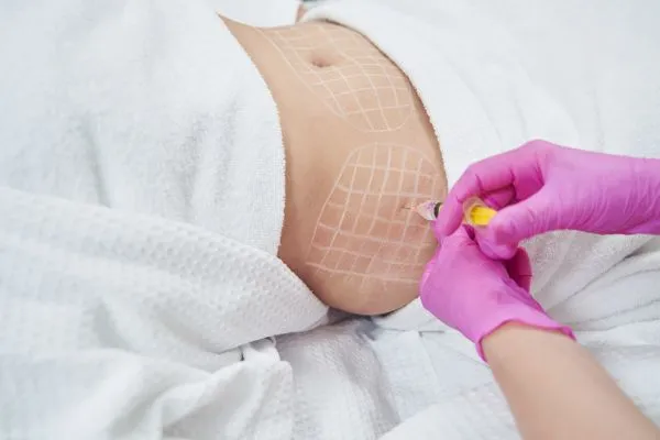 image of fat dissolving injections on love handles to help combat weight gain Stevenage Ware