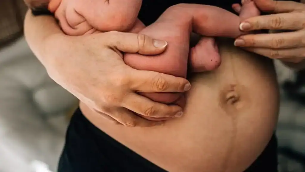 Why Is My Stomach Still Big After Pregnancy Stevenage Ware?